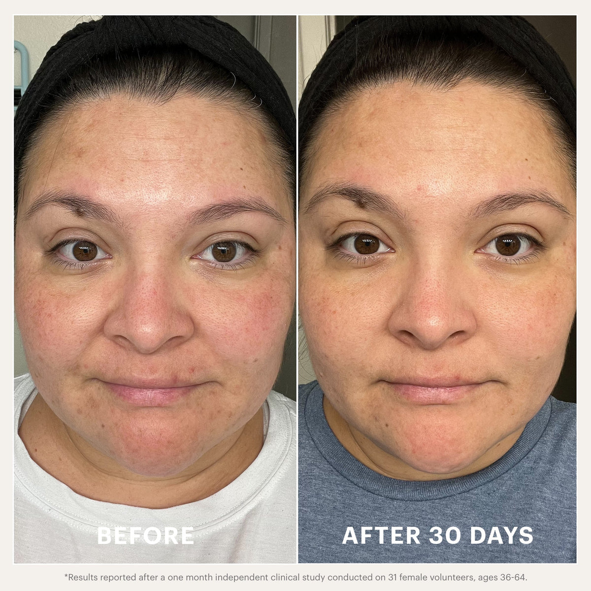 Clarify & Balance Renew Serum